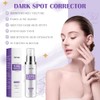 Crema correctora de manchas oscuras para rostro y cuerpo, crema
