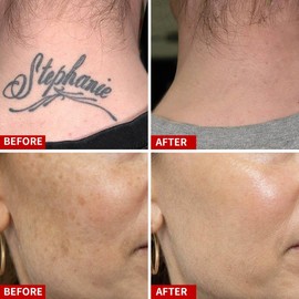 DJDAI Red Pen Rechargeable with Glasses, white