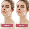 Reusable V-Line Face Strap, Soft Silicone Face Chin Up Tape