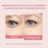 Crema Contorno De Ojos,arrugas,bolsas Y Ojeras Obscuras 30g Normal Día/noche