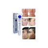 RM Beauty Crema Facial Noche Antiacné Elimina Granos Espinillas 30g