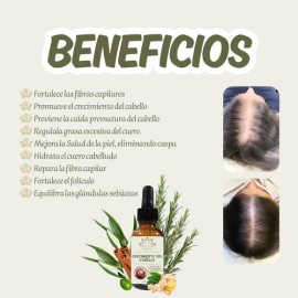 Aceite Capilar Ozonizado Romero Anti-caida De Cabello 30ml