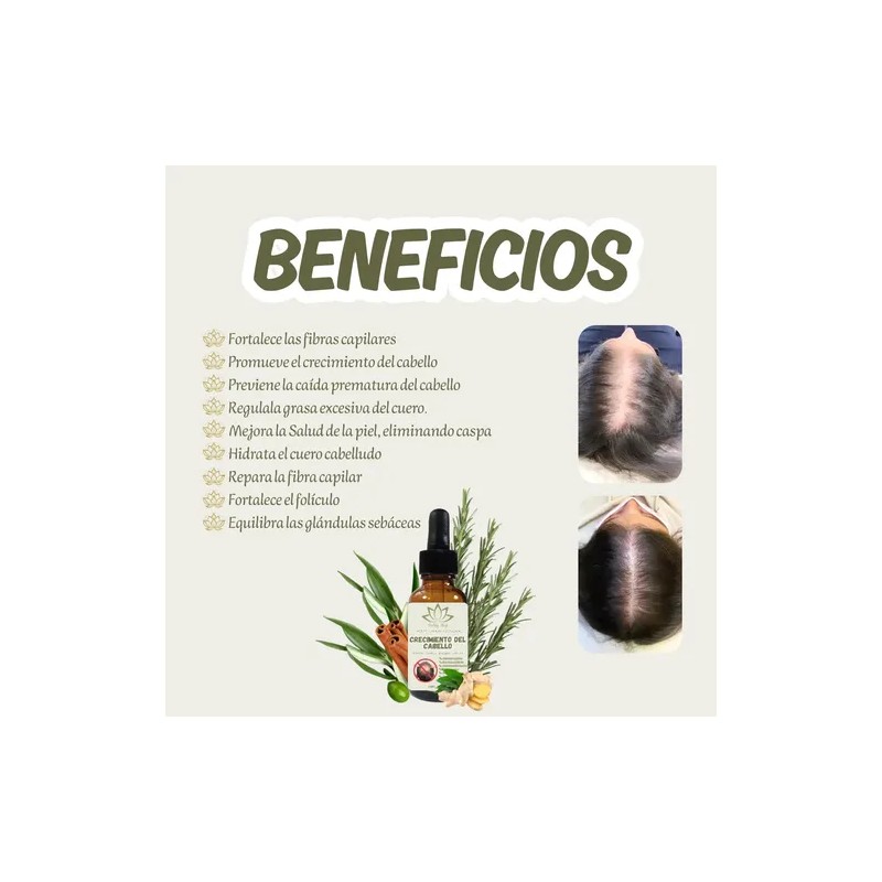 Aceite Capilar Ozonizado Romero Anti-caida De Cabello 30ml