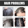 Bluemega Jabón Negro Para Cabello- Cuidado Capilar, Reduce las canas