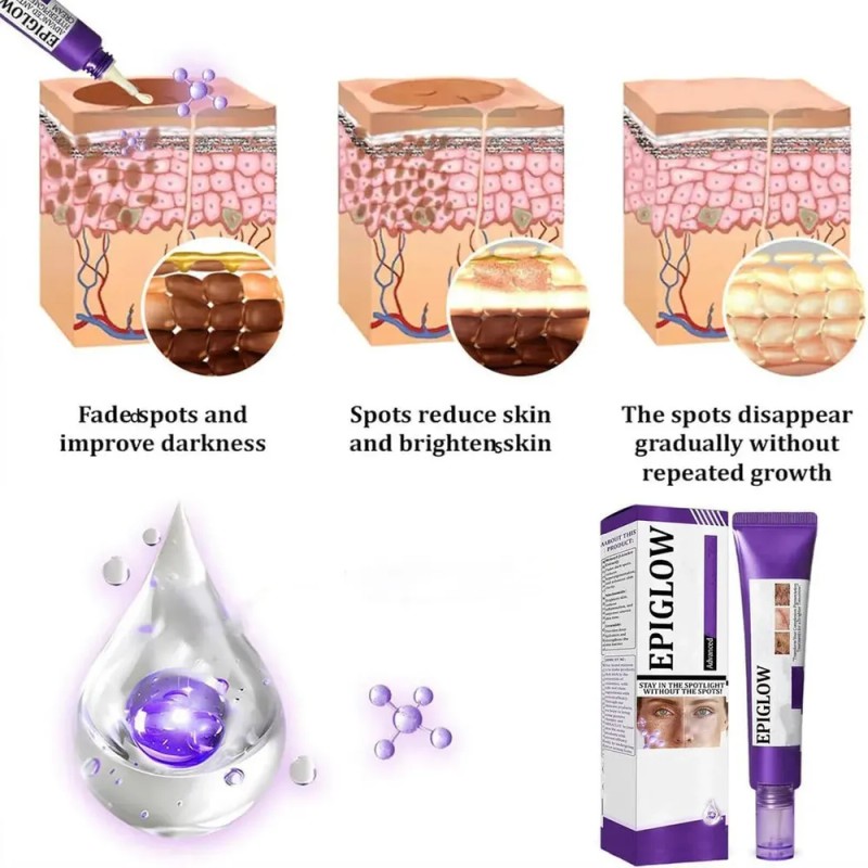 Dmm Crema Antihiperpigmentación Avanzada Epiglow Melanex,