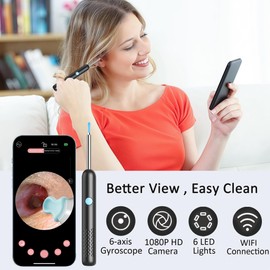 Ear Wax Removal Tool Camera, Ear Cleaner with Camera and 6 LED Light, 1080p HD Ear Scope, Ear Cleaning kit, 9 Ear Tools and 20 Ear Replacement Tips, for iOS & Android (Black)