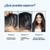 2pcs Rollo Para Crecimiento Del Cabello Ouyea Con Romero