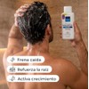 ROGMA Biotechnologies Shampoo Anticaída 460 ml | Con Trichogen, Cafeína,