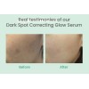 Serum Axis-y Dark Spot Correcting Glow Niacinamida 5% 50ml Rostro