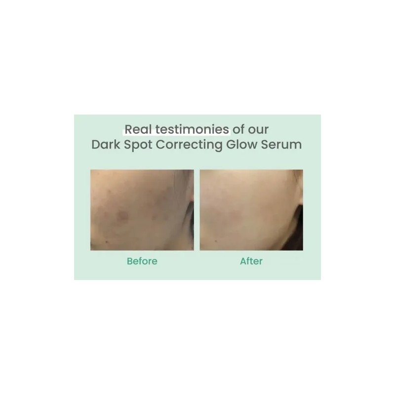 Serum Axis-y Dark Spot Correcting Glow Niacinamida 5% 50ml Rostro