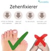 Toe Fixers with Padding for Hammer Toe and Overlapping Toes,