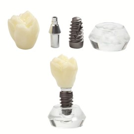 Dental Clear Implant Model Detail Implant Demonstration Detachable for Training and Education