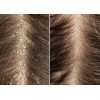 Shampoo Adiós Caspa Sheló Elimina Resequedad Restaura Cabell