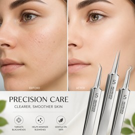 Precision Blackhead Tweezers for Facial Skincare – Ultra-Fine Stainless Steel Tool for Nose, Chin & Beauty Routines