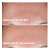 Biotiks Serúm Con Retinol, Vitamina B3+rosa Mosquera Y Colágeno 30ml
