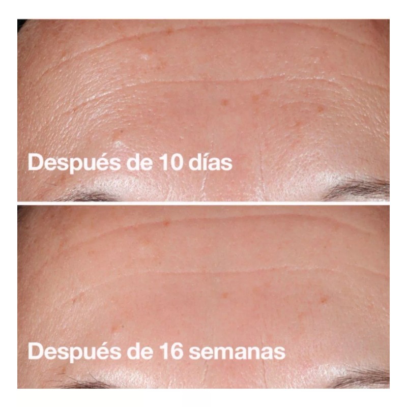 Biotiks Serúm Con Retinol, Vitamina B3+rosa Mosquera Y Colágeno 30ml
