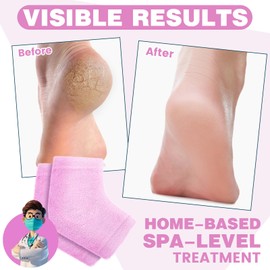 TEAWOO 3 Pairs Fuzzy Moisturizing Heel Socks for Dry Cracked Feet Women, Cracked Heel Repair, Cracked Heel Treatment (Pink)