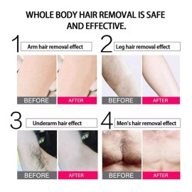 Lomxe Dispositivo De Máquina De Depilación Láser Permanente De Dep