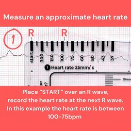 1Pc ECG 7 Step Ruler, ECG 7 Step Ruler for ECG/EKG Interpretation, EKG Ruler Plastic Ruler Measuring Tool, EKG 7 Step Ruler, Transparent EKG Calipers Measuring Tool Follow a 7 Step Plan