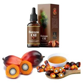 Yl Aceite De Batana 30ml For Cabello, Crecimiento Y