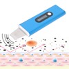 Ultrasonic Skin Scrubber Blackhead Removal Adjustable Face Pore Cleaner Beauty