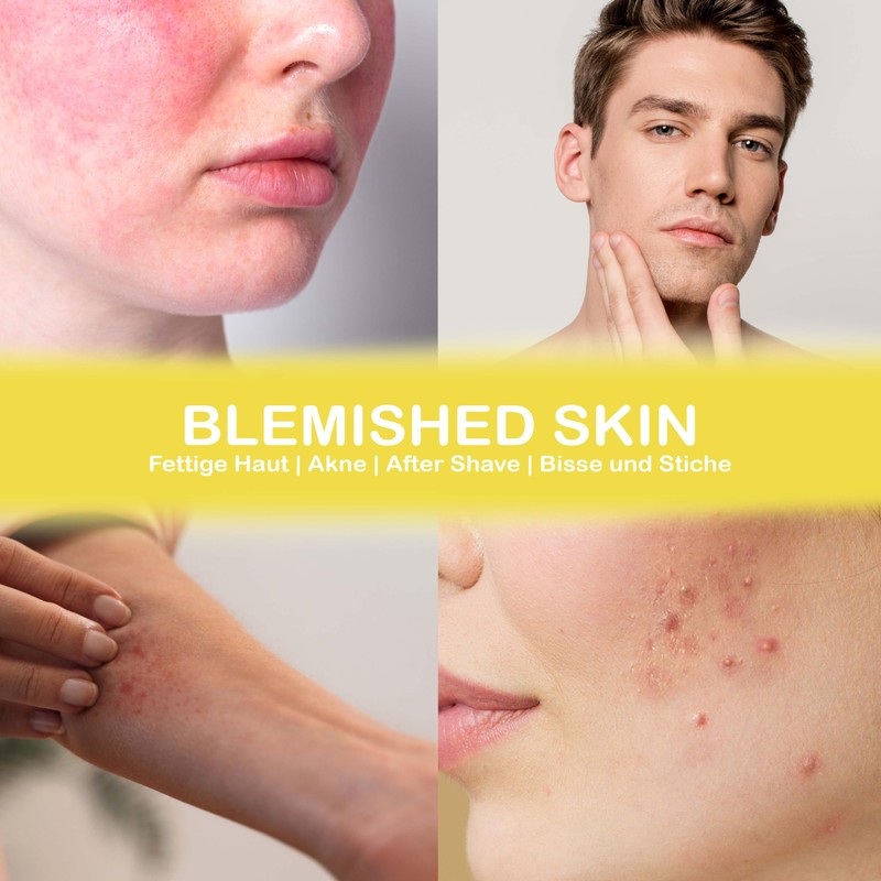 Organic Lemon Hydrol Lemon Blossom Water 100% Natural 100 ml