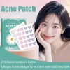 40/80/100/200pcs Pe Acne Patch Skincare Cute Design
