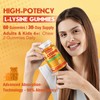 VAJYKEWJY L-Lysine Gummies 1000 mg for Immune Support, Delicious Orange