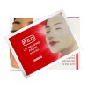 6 Parches Anestesia Crema Previa Micropigmentación Labios