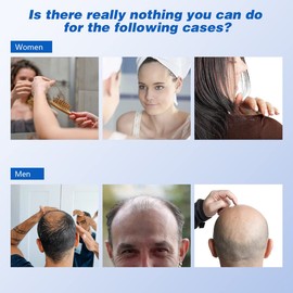 L-Carnosin - 120 Kapseln - Hochdosiert mit 1000mg pro Tagesportion - Reine Aminosäure gewonnen durch pflanzliche Fermentation - Ohne Zusatzstoffe, vegan