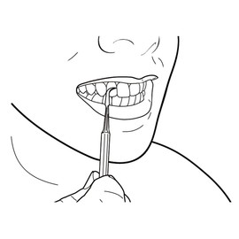 Petty & Sahi International Tartar Remover, 40411, 1 Piece (x 1)