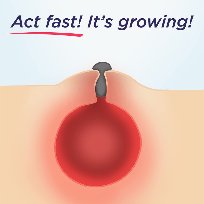 Clearasil Deep Cleansing Pads Extra Strength