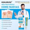 Crema De Uñas Antifúngico Para Uñas De Manos Y Pies