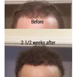 TC Beauty Hair Growth Product For Men Women Natural Oil Serum Loss Grow  TCBEAUTY 30ml