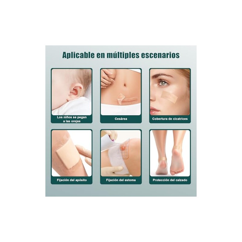 Parches de Silicona para Eliminar Cicatrices, Tratamiento Profesional para Cicatrices