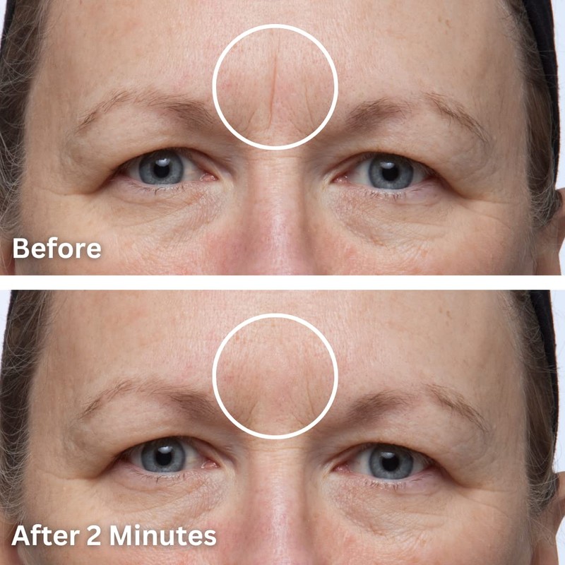 Dermaflage Dermaflage Single Applicator, Scar Concealer Refill (Light)