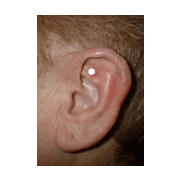 Magnetic Less Stress Acupressure Magnets One Personal Kit New Plastic