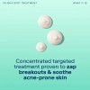 Skinfix Acne+ 2% Bha Tratamiento De Manchas Para El Acné: