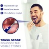 LED Tonsil Stone Remover | Bad Breath Cure | Easily