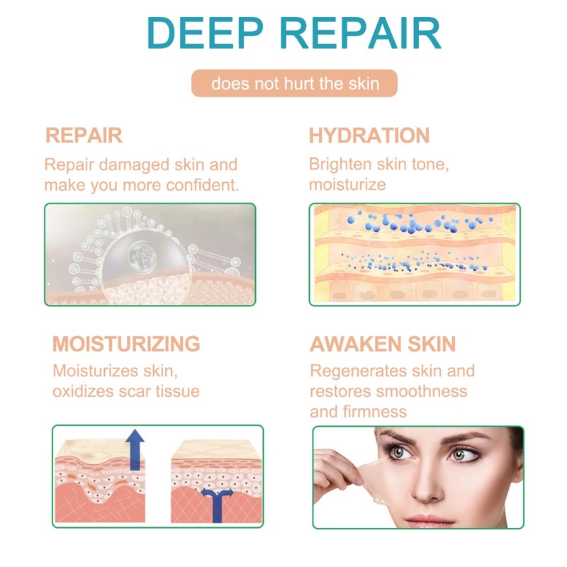 3 Meters Silicone Scar Stickers to Reduce Itching and Redness