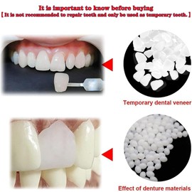 Provisional Tooth Repair Kit-Thermal Fitting Beads Granules and Fake Teeth for Provisional Fixing Missing and Broken Tooth (Teeth - Piece White)