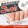 Como Life Nail Plaque Remover R for Winding Nails, Nail
