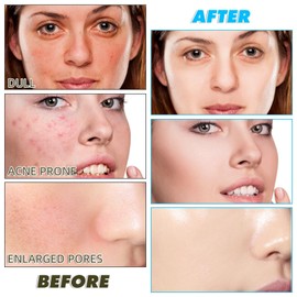 60pcs Turmeric Kojic Acid Cleansing Pads,Kojic Acid & Turmeric Face Pads,Gentle Face Exfoliating Pads,Turmeric Kojic Face Cleansing Pads,Unclog Pores Facial Cleansing Pads,Reduce Acne Face Wipes