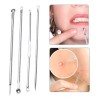 Unic Kit Anti Acné Extractor De Puntos Negros Y Espinillas