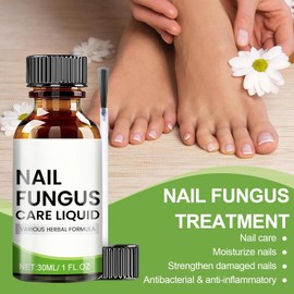 Nail Care for Toenails, Nail Repair, Protection & Strengthening Brittle Nails, Nail Care Nourishing, Nail Care Oil, Nail Care, Toenail Treatment with Nail File, 30 ml