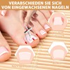 Ingrown Toenails Set, Nail Clip, Toenails, Toenail Correction, Nail Correction
