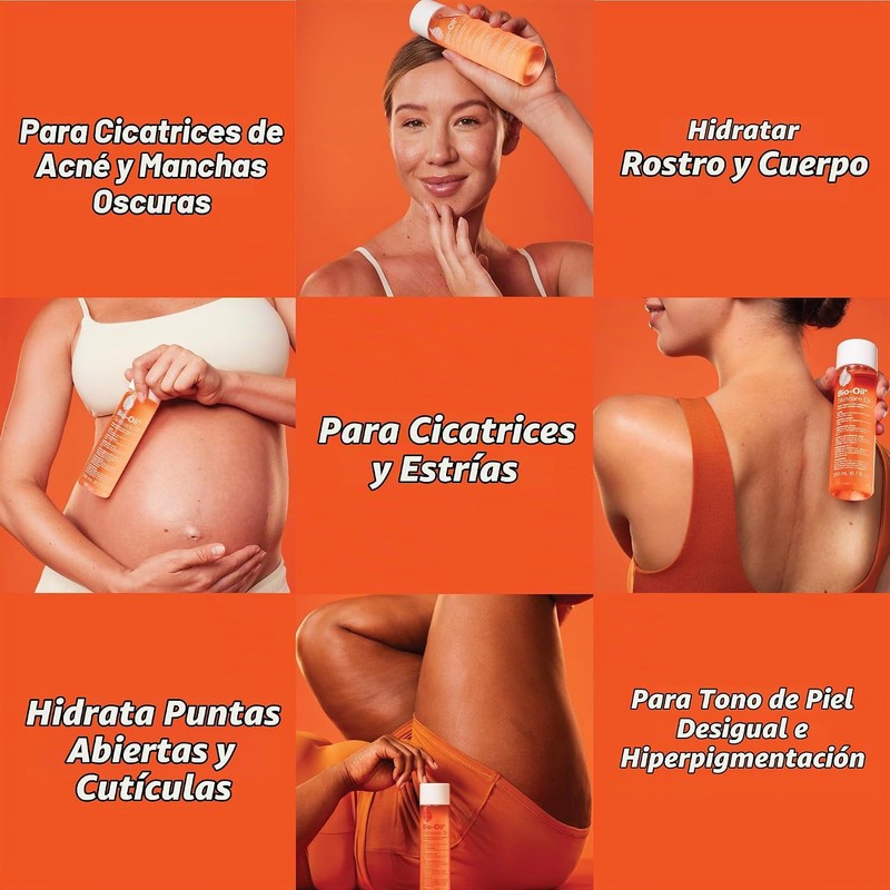 Bio-Oil® 6.7oz: Multiuse Skincare Oil