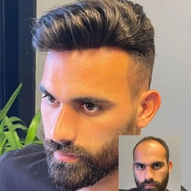 blazingfire Mens Toupee Hair Piece System for Men Indian Human Hair Fine Mono with Npu Protesis Capilar hombre Hair Replacement Wig Male Toupee Hairpiece 7x10 Inch Black Color