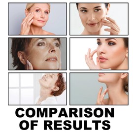 Neck Creams for Firming Roller,Firming Neck Cream,Neck Creams for Tightening,Neck Collagen Cream,Face Moisturizer for Women,Firm/ing Crea/m for Loose Skin,Ne/ck Tightening Cre/am,Wrinkle Cre/am