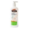 Kit Anti Estrías Y Embarazo Bálsamo Crema Loción Y Aceite